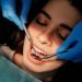 Uncover the Real Wisdom Tooth Extraction Cost: What You’ll Actually Pay